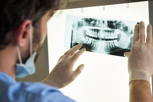 Demystifying Dental X-Rays: Are They Safe?