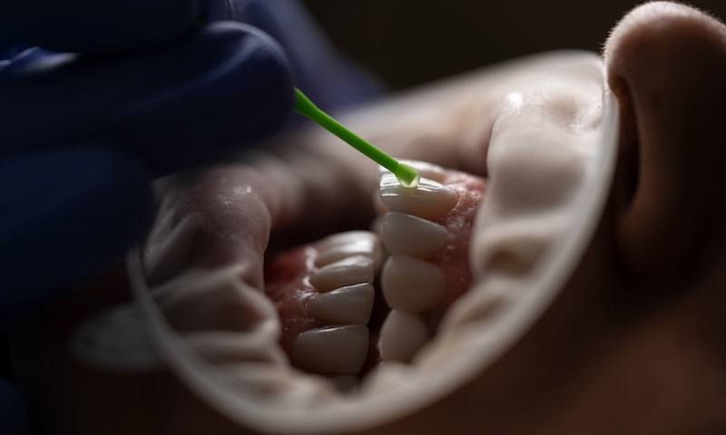 Dealing with Sensitive Teeth: Solutions That Work